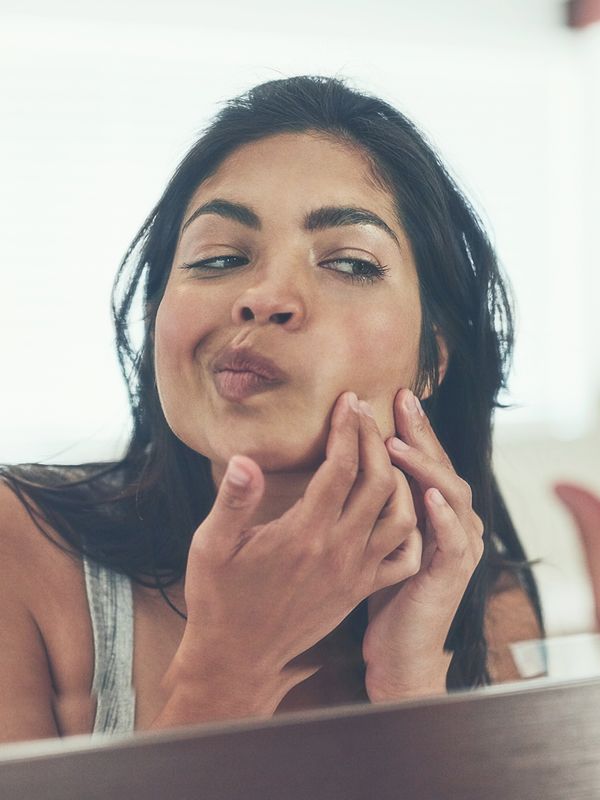 5 Ways To Treat Acne Scars