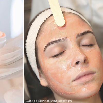 A Beginner’s Guide To Chemical Peels