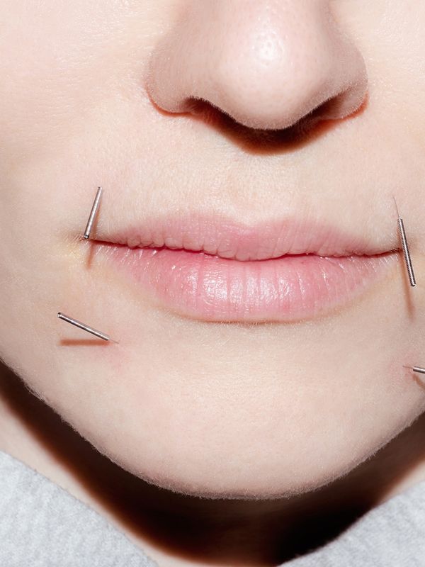 Cosmetic Facial Acupuncture: What It Is & Where To Try It 