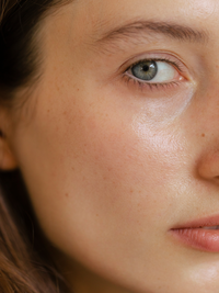 The Skin-Tightening Treatment Everyone’s Talking About 