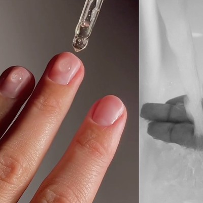 How To Bring Your Nails Back From The Brink