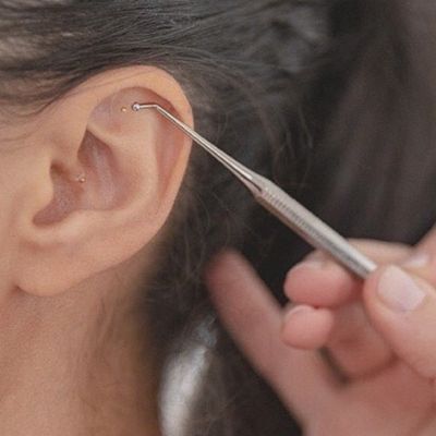 What You Need To Know About Ear Seeding