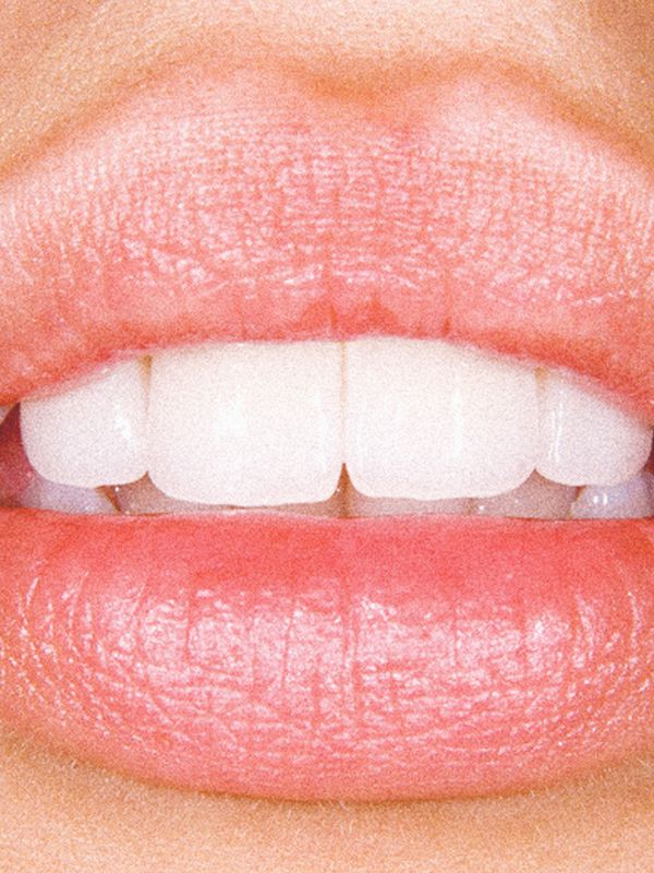 Invisalign: What You Need To Know
