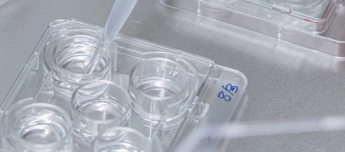 How & Why Nana Decided To Freeze Her Eggs