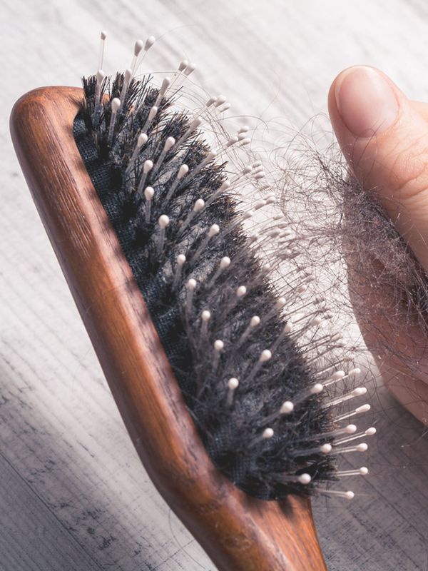 10 Easy Ways To Prevent Hair Loss