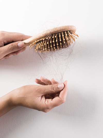 Hair Loss And Everything You Need To Know 