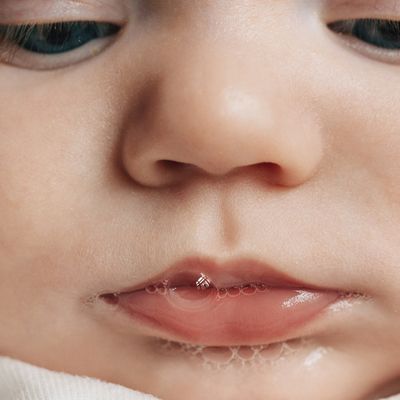 How To Help A Baby With Tongue Tie
