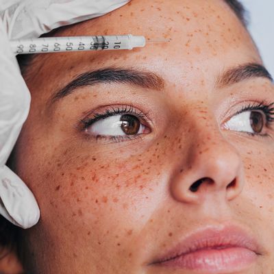 What You Need To Know About ‘Baby’ Botox 