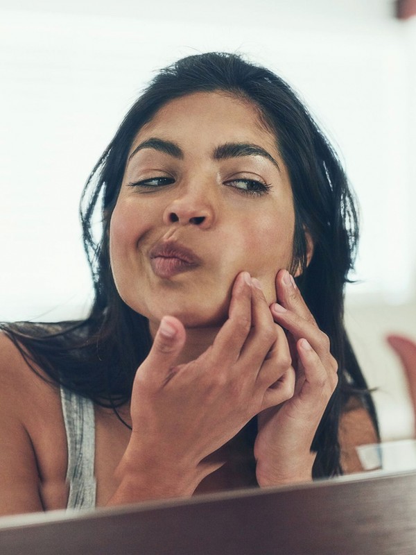 Why Whiteheads Happen & How To Treat Them