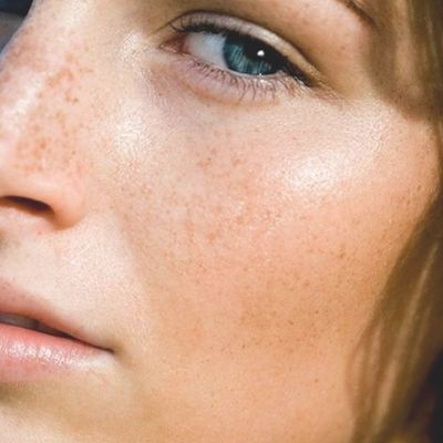 How To Treat Spot-Prone Skin