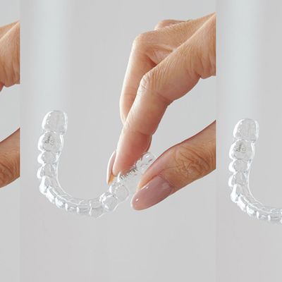 What You Need To Know About Invisalign
