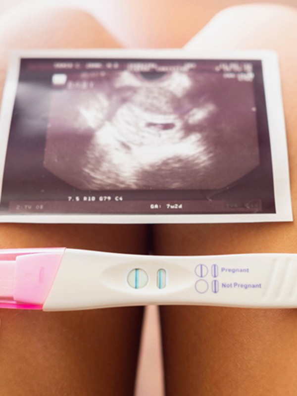 Our IVF Journey: Lucy & Amy