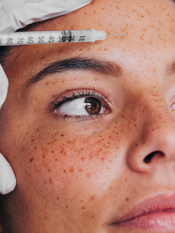 What You Need To Know About ‘Baby’ Botox 