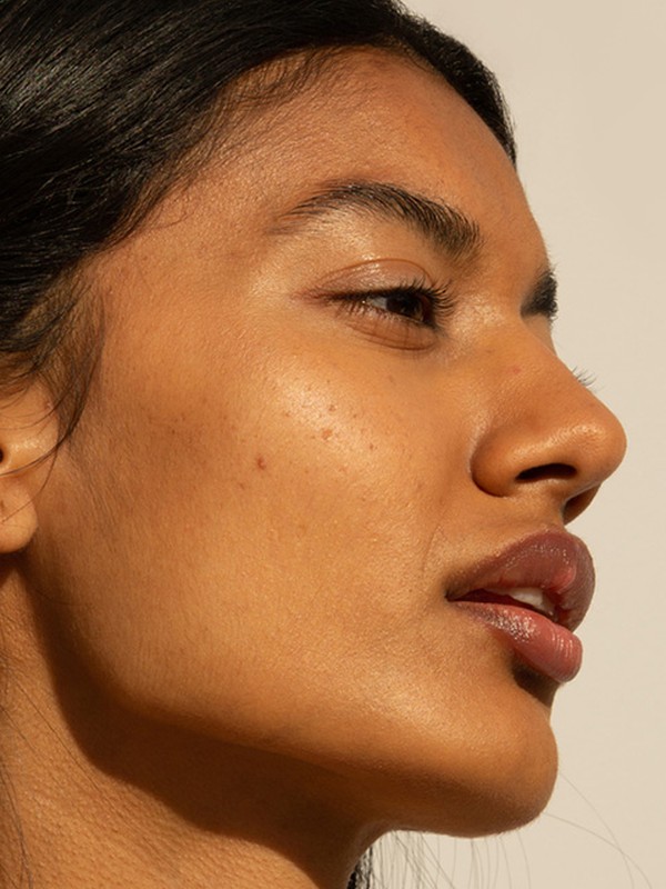 Buccal Fat 101: What You Need To Know