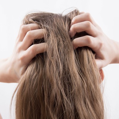 Beauty 101: Why You're Getting Dandruff & How To Treat It