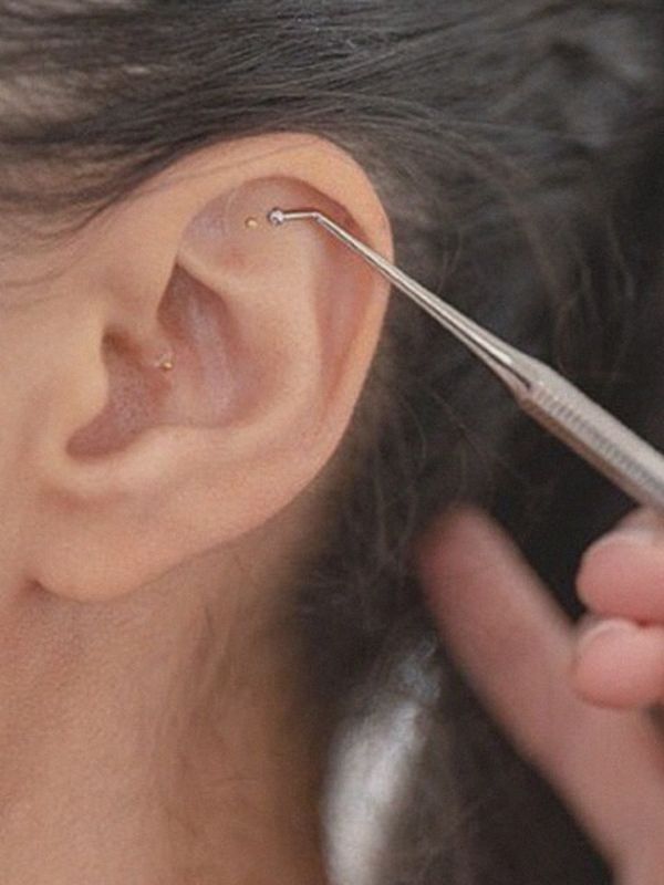 What You Need To Know About Ear Seeding