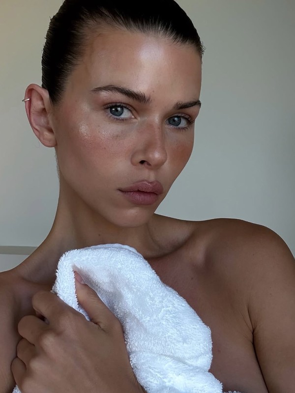 The Best Products To Soothe Sunburnt Skin