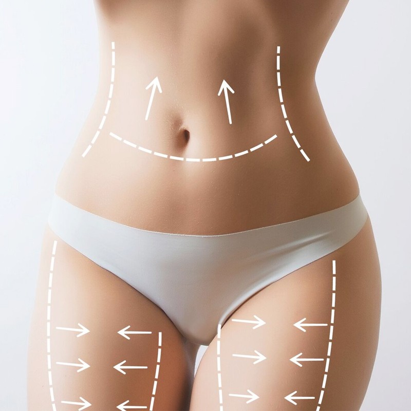 The Body Contouring Treatment That Actually Works