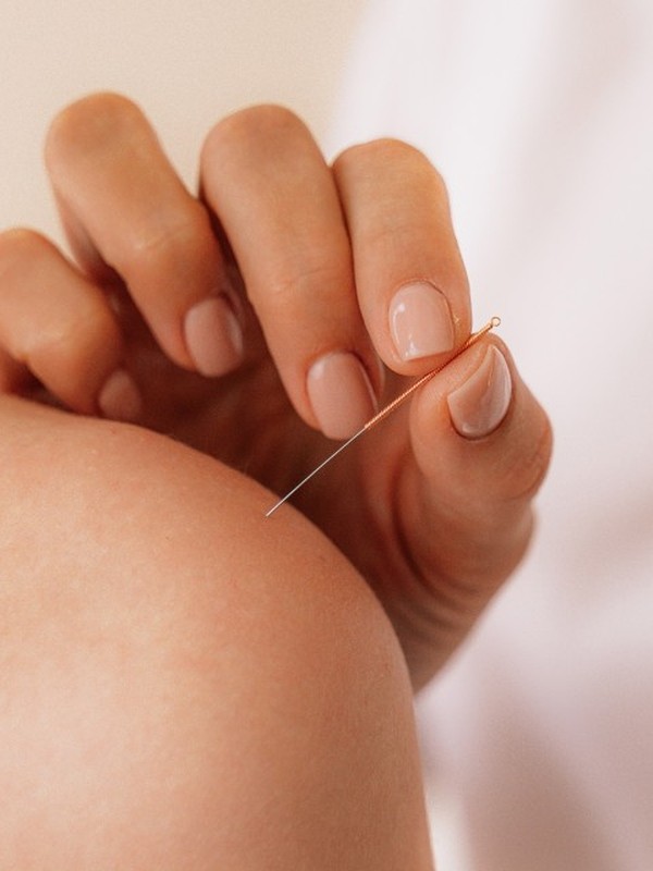 The Acupuncturists To Know