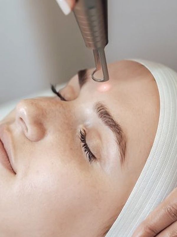 An Expert Guide To Laser Facial Treatments