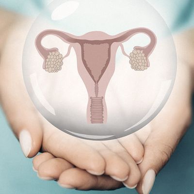 PCOS 101: From Diagnosis To Treatment 