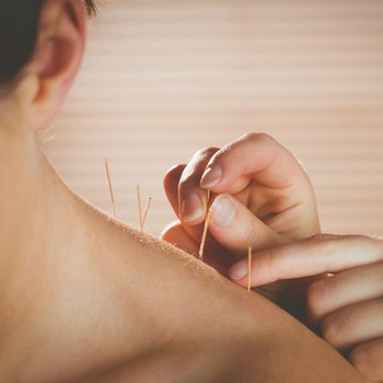 My Interesting Job: Acupuncturist