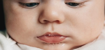 How To Help A Baby With Tongue Tie