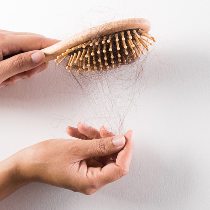 Hair Loss And Everything You Need To Know