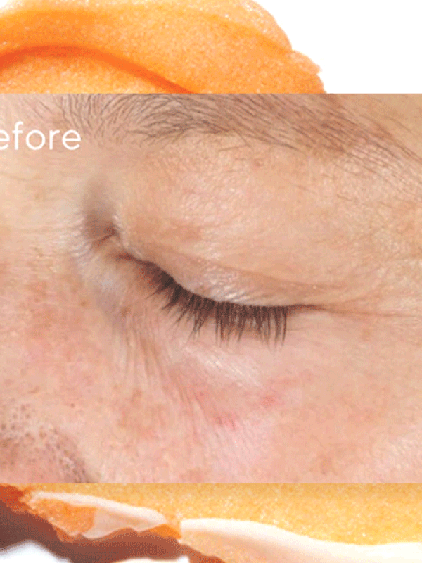 The Best Remedy For Dull, Bumpy Skin