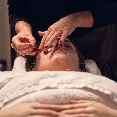 Cosmetic Facial Acupuncture: What It Is & Where To Try It 