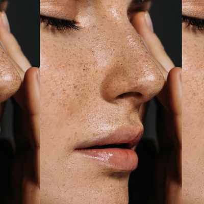 How To Reduce The Appearance Of Pores