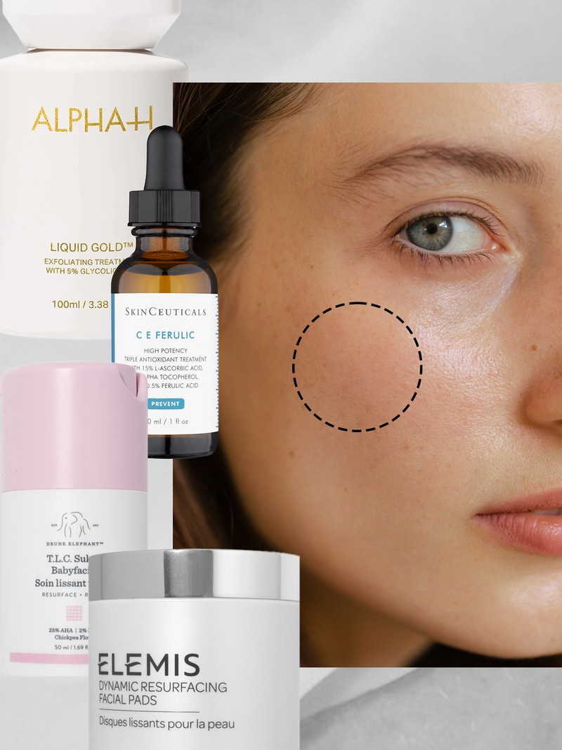 How To Get Rid of Pigmentation