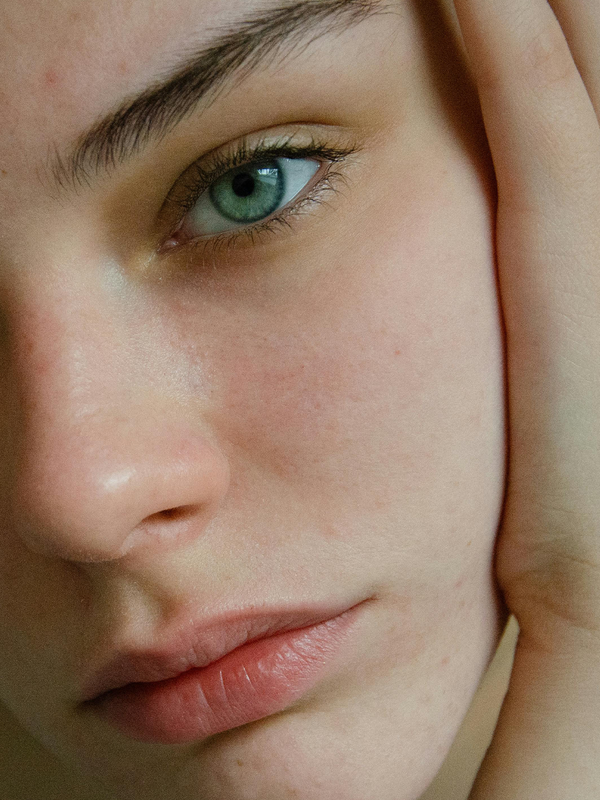 What You Need To Know About Rosacea & How To Treat It 