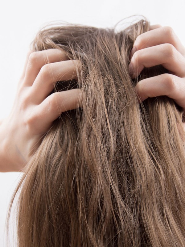 Beauty 101: Why You’re Getting Dandruff & How To Treat It 