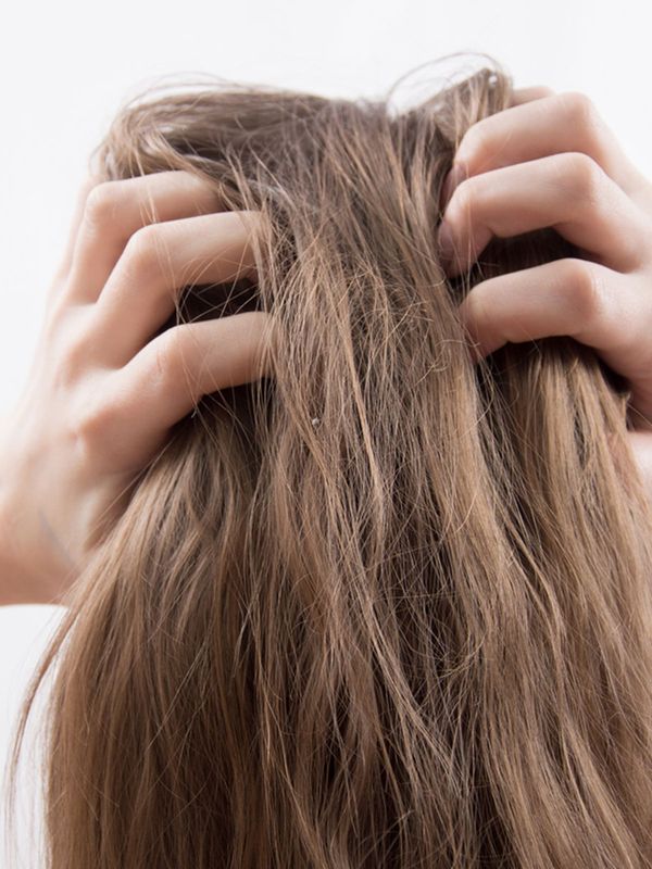 Beauty 101: Why You’re Getting Dandruff & How To Treat It 