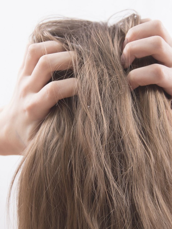 Why You’re Suffering From Scalp Irritation & How To Treat It